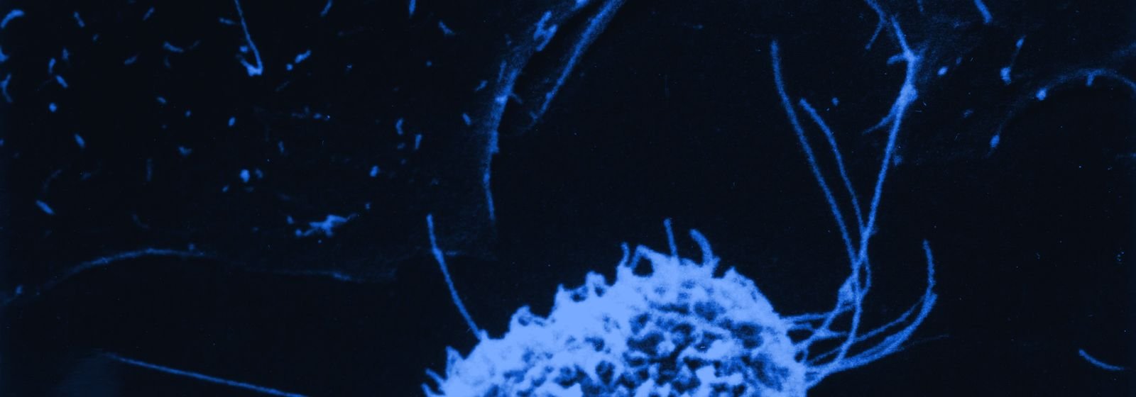 Célula vista al microscopio electrónico de barrido, en tonos azules
