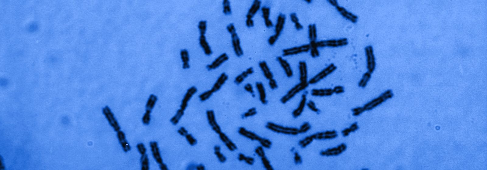Cromosomas de una mujer (46,XX) vistos al microscopio, en tonos azules