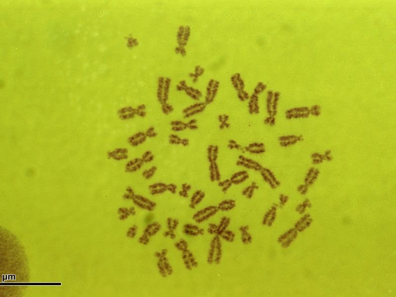 Cromosomas humanos vistos al microscopio