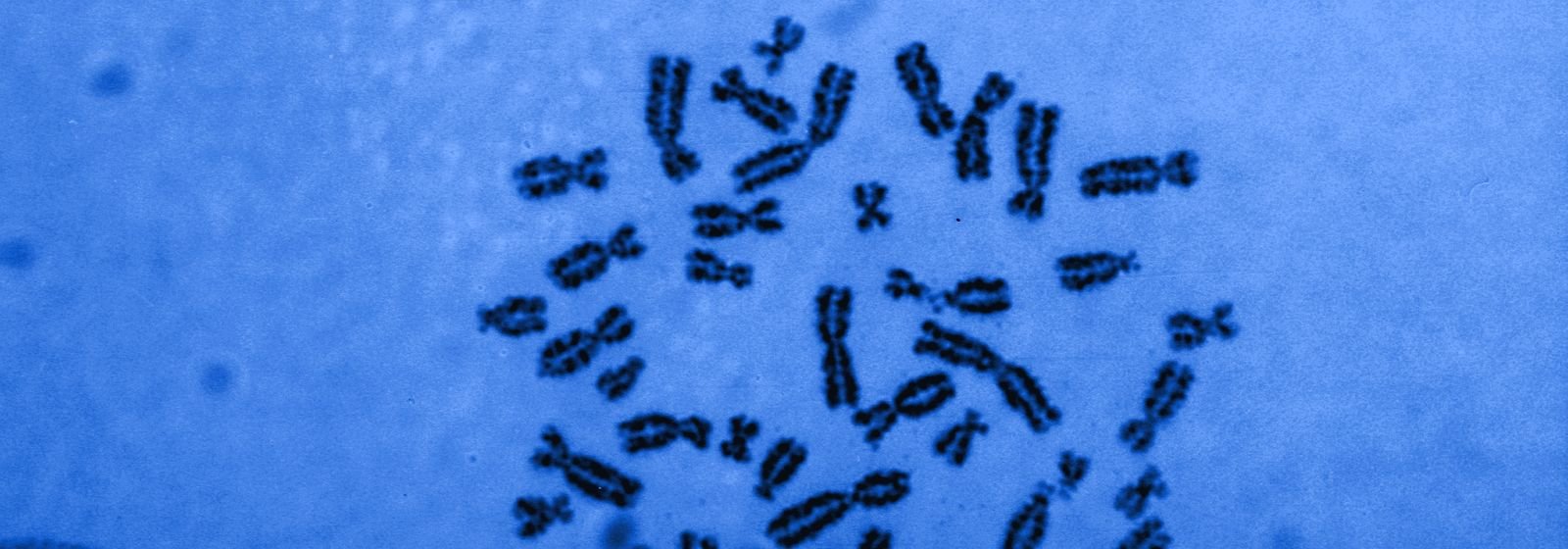 Cromosomas humanos vistos al microscopio, en tonos azules