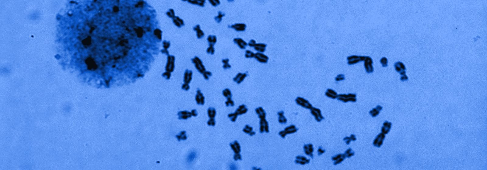 Cariotipo humano 47,XXY visto al microscopio, en tonos azules