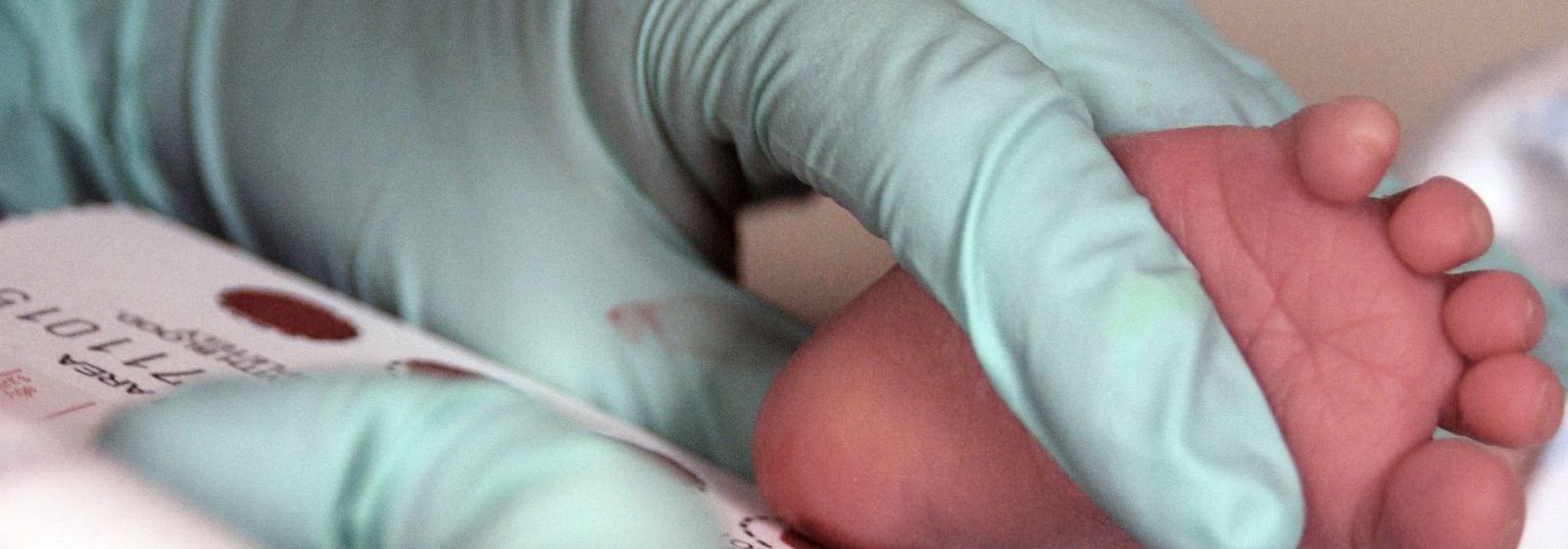 Toma de una muestra de sangre del talón de un recién nacido